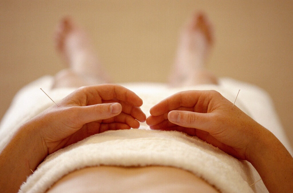 Acupuncture-1